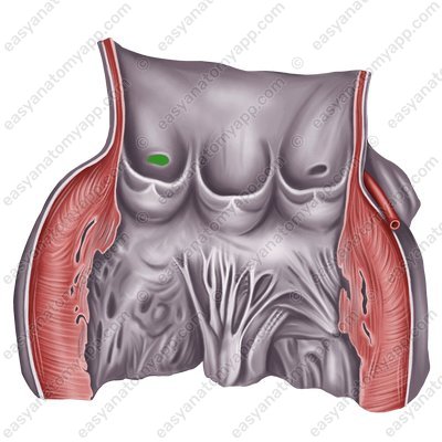 Правая венечная артерия (a. coronaria dextra) – устье